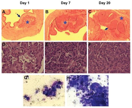 Figure 5 Establishment of dog orthotopic bladder cancer xenograft model in mice. Whole bladders were harvested on days 1 (A and D), 7 (B and E), and 20 (C and F) after injection of cancer cells for hematoxylin and eosin staining and examination. Blue arrows show an intact normal urothelial layer lining the bladder cavity on day 1 and replacement of the normal urothelial layer and bladder cavity by xenograft on day 20. Blue stars show the injection (day 1) and expansion of cancer cells (day 7) at the lamina propria and invasion into the muscle layer on day 20. (A, B and C: 4×; D, E, and F: 40×). (G) urine sediment cytology evaluation on day 20 (40×). (H) The touch preparation smear from the solid tumor in the bladder at day 20 (40×).