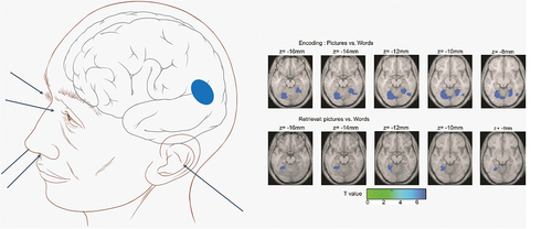 Figure 1. Different senses activate certain parts of the brain where the feeling of other senses is stored and can be observable using functional magnetic resonance imaging (fMRI).