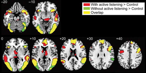 Figure 2. Significant activation while viewing an ostensible evaluator’s assessment relative to the control condition. Thresholds were set at uncorrected p < .01 at the voxel level and FDR corrected p < .05 at the cluster level. Red, green, and yellow indicate the activation during an ostensible evaluator’s assessment with active listening behavior, without active listening behavior, and the overlapping activation, respectively. Overlapping activation during the ostensible evaluators’ assessments with and without active listening behaviors occurred in the mPFC, IFG, STS, and anterior insula.