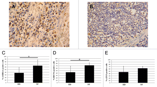 Figure 3. Autophagy in axillary lymph nodes. (A) AMBRA1 immunostaining on lymph nodes from HIV-1-infected patients respect to noninfected ones (B). (C–E) Quantification of the AMBRA1, BECN1, and ATG5 labeling. Original magnification: (A and B) 40×. *P < 0.05, **P < 0.01, ***P < 0.001.