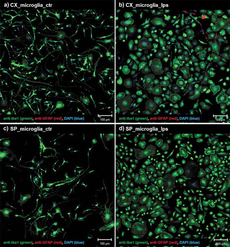 Figure 1. Morphological changes of microglia after LPS treatment. (a) Cx-M non-treated (control) and (b) treated with 500ng/mL LPS for 24h. (c) SpC-M non-treated (control) and (d) treated with 500ng/mL LPS for 24 h. Immunostaining using anti-Iba1 antibody (green), marker for microglia cells, anti-GFAP antibody (red), marker for astrocytes and DAPI (blue) stain for cell nucleus. Scale bars: 100 µm.