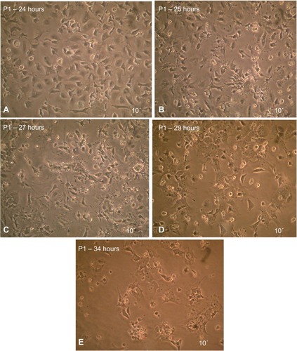 Figure 6 MSCs after induced differentiation by BME, which showed the spherical shape of cells and their branched form toward the neural cells as revealed under inverted microscope.