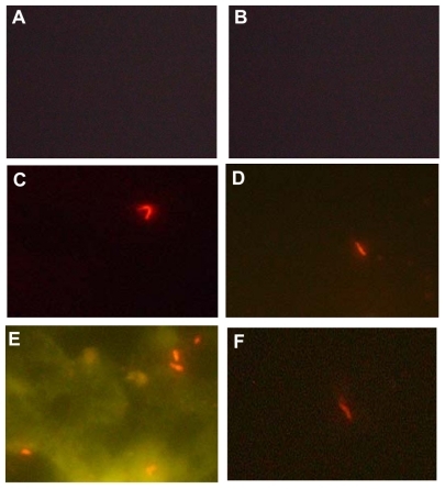 Figure 4 Fluorescence images (100× oil). (A) negative control, phosphate-buffered saline in place of the specific monoclonal antibody, (B) negative control, Escherichia coli in place of the Mycobacterium tuberculosis. (C, D and F) Specific interaction of bioconjugated nanoparticles with M. tuberculosis; (E) the nonspecific interaction (autofluorescence) despite displaying M. tuberculosis with a bright fluorescence.