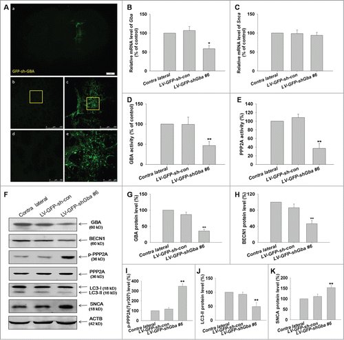Figure 9. Loss of GBA function leads to SNCA accumulation through inhibition of autophagy involving PPP2A inactivation in rats. (A) Confocal immunofluorescence microscopy reveals an enhancement of GFP signal following LV-GFP-shGba #6 injection into the left striatum of rats, with no fluorescence detected on the contralateral (uninjected) side. Scale bar = 500 μm. (B, C) LV gene transfer vectors encoding GFP-shGba #6 (LV-GFP-shGba #6) and scrambled negative control (LV-GFP-sh-con) were injected into the left striatum of rats; 1 wk later, RNA was extracted from whole striatal tissue homogenates for analysis of Gba and Snca mRNA expression by quantitative RT-PCR. (D, E) GBA and PPP2A activities were reduced in the striatum of rats infected with LV-GFP-shGba #6. (F) GBA expression, autophagy level, phosphorylation level of PPP2A at Tyr307, and SNCA expression were assessed by western blotting. (G) GBA protein expression was reduced in the striatum of rats infected with LV-GFP-shGba #6. ((H)to K) Downregulation of BECN1 protein expression, increased phosphorylation of PPP2A at Tyr307, decreased LC3-II level, and increased SNCA protein expression were observed in the striatum infected with LV-GFP-shGba #6. *P< 0.05, **P< 0.01 vs. contralateral group; n = 3.