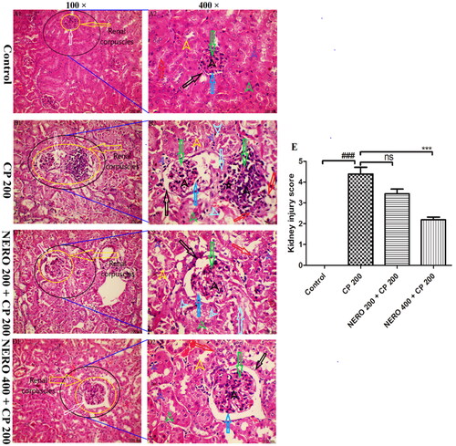 Figure 6. (A1-D1 and A2-D2) Showing the effect of nerolidol 200 and 400 mg/kg, p.o., against cyclophosphamide-induced histopathological aberrations (H & E staining) in the renal tissue. A1 -D1 showing renal corpuscles (glomerulus, bowman’s capsule, and bowman’s space) [yellow arrow] and bowman’s space [white arrow]. A2 -D2 showing glomerulus (long green arrow), parietal layer (long black arrow), cellular disintegration (long red arrow), podocytes (dark long blue arrow), fibrotic changes (long light blue arrow), mesangium with atrophic changes (short black arrow), pyknosis (short dark blue arrow), vacuolation (short light blue arrow), DCT (short yellow arrow) and PCT(short green arrow). figure E represents the semi-quantitative analysis of the kidney injury score. One-way ANOVA, i.e., tukey’s multiple comparison test was used for statistical analysis. (H & E staining, 100 × and 400 × magnification, respectively.).