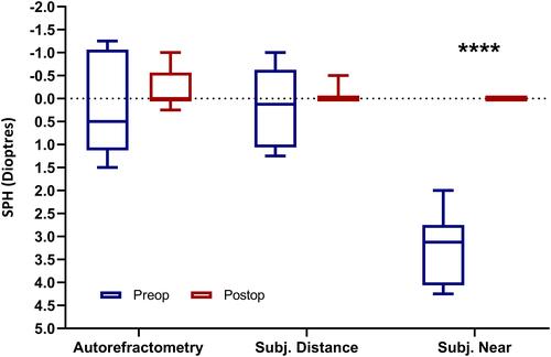 Figure 5 Spherical refractive errors measured with autorefractometer and subjectively for distance and near prior to and 6 months after the implantation of the secondary lens.Notes: Boxplots represent mean ± SD, and minimum and maximum values of n= 18 eyes (11 patients). Matching pre- and postoperative variables were compared with the two-tailed paired t-test or its non-parametric equivalent. ****p<0.0001.Abbreviations: SPH, spherical refraction; SD, standard deviation.