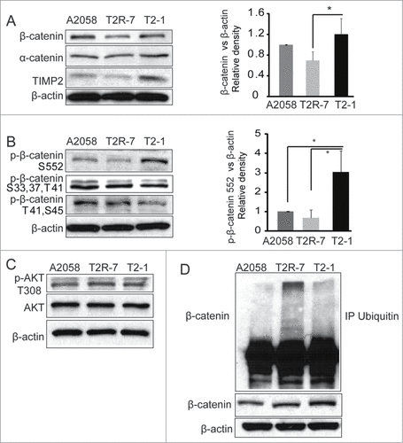 Figure 1. TIMP-2 affects the total, phosphorylated, and ubiquitinated β-catenin in A2058 cells. (A) β-catenin protein expression in human melanoma cell lines: parental A2058 expressing, A2058T2R-7 (T2R-7) under-expressing and A2058T2-1 (T2-1) over-expressing TIMP-2.Densitometry of β-catenin. (B) Immunoblot of phospho-β-catenin in A2058, T2R-7 and T2-1 cells. Densitometry of p-β-catenin (ser 552). (C) Immunoblot of total and phosphor-AKT in A2058, T2R-7 and T2-1 cells.Data are expressed as mean ± SD. #P< 0.05. n= 3 separate experiments. (D) Representative ubiquitination of β-catenin in cells treated with 20μM MG262 for 4 hours. Using anti-β-catenin antibody pulled down, detected with anti-total ubiquitin antibody. β-catenin and actin showed input.