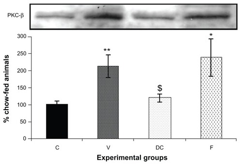 Figure 2 PKC-β protein expression in rat skeletal muscle. Equal amounts (40 mg/well) of protein were separated by SDS-PAGE and immunoblotted with PKC-β antibodies.