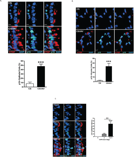 Figure 5. CTGF expression is positively associated with p16 accumulation in lung epithelial cells in vivo. (A) Analysis of CTGF and p16 co-expression in airway epithelium of mice exposed to CS and IAV infection. Representative micrographs showing CTGF- (red) and p16 (green)-positive cells in airway tissues from mice exposed to CS and IAV infection compared with CS and mock infection. Nuclei were counterstained with DAPI (blue) (scale bar, 10 μM). Lower panel shows quantitative analysis of p16-positive cells (***p < 0.001). (B) Analysis of CTGF and p16 co-expression in alveolar cells of mice exposed to CS and IAV infection. Representative micrographs showing CTGF- (red) and p16 (green)-positive cells in alveolar tissues from mice exposed to CS and IAV infection compared with CS and mock infection. Nuclei were counterstained with DAPI (blue) (scale bar, 10 μM). Lower panel shows quantitative analysis of p16-positive cells (***p < 0.001). (C) Analysis of CTGF and p16 co-expression in airway epithelium of ex-smokers with COPD. Representative micrographs showing CTGF- (red) and p16 (green)-positive cells in airway epithelium of ex-smokers with COPD at GOLD stage 0, 2 and 3 or 4. Nuclei were counterstained with DAPI (blue) (scale bar, 10 μm). Right panel shows quantitative analysis of p16-positive cells from the three clinical groups (**p < 0.01; ***p < 0.001). (D) Analysis of CTGF and p16 co-expression in alveolar cells of ex-smokers with COPD. Representative micrographs showing CTGF- (red) and p16 (green)-positive cells in alveolar cells of ex-smokers with COPD at GOLD stage 0, 2 and 3 or 4. Nuclei were counterstained with DAPI (blue) (scale bar, 10 μm). Right panel shows quantitative analysis of p16-positive cells from the three clinical groups (**p < 0.01; ***p < 0.001).