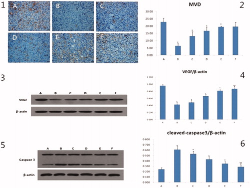 Figure 5. The results of MVD, VEGF, caspase3 in vivo. 1: the immunohistochemical pictures of MVD, the scale bar = 20 μm. 2: the bar graph of MVD of different groups, compared to mode group, *p < .01. 3 and 5 are the electrophoresis picture of VEGF and caspase3, respectively. 4 and 6 are bar graph of VEGF and caspase3, respectively. The β-actin is as internal standard, compared to mode group, △p < .05, *p < .01. A: mode group; B: adriamycin group; C: high dose of GAMCLCL group; D: middle dose of GAMCLCL group; E: Low dose of GAMCLCL group; F: curcumin group.