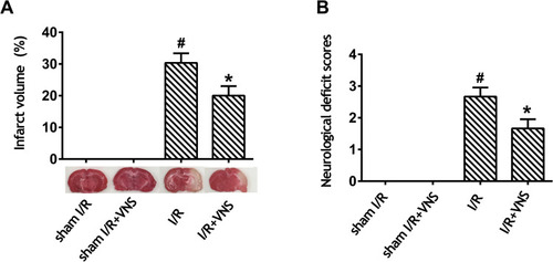 Figure 1 Vagal nerve stimulation improves neurological scores and decreases infarct volume after ischemia–reperfusion injury. (A) Infarct volume was measured by 2,3,5-triphenyltetrazolium chloride staining. Obvious infarction was detected in rats who had undergone ischemia–reperfusion (I/R), and infarction was improved after vagal nerve stimulation. (B) A neurological evaluation was performed using a modified five-point scoring system. Obvious neurological deﬁcit was detected in rats who had undergone I/R and neurological deﬁcit improved after vagal nerve stimulation; #P < 0.05 vs sham I/R group, *P < 0.05 vs I/R group.