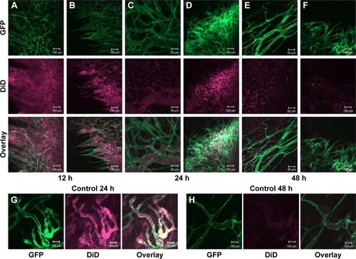 Figure 5 Intravital microscopy imaging of the behavior of DiD-labeled (purple), TAT-modified (A–F), or DiD-labeled plain liposomes (G, H) inside B16F0 tumors using the dorsal skin-fold chamber. Mice were injected with 5 µmol of lipid. TAT-modified liposomes were found to be associated with tumor cells after extravasation at different time points, while plain liposomes hardly bound to tumor cells.Abbreviations: TAT, transactivator of transcription; DiD, 4-chlorobenzenesulfonate salt; GFP, green fluorescent protein.