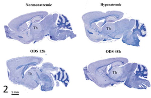 Figure 2. Pane from sagittal sections of normatremia (NN) or Sham, hyponatremia (HN), 12 h after correction of hyponatremia (ODS12h) and 48 h after correction of hyponatremia (ODS48h) mice brains. All stained with hemalum and eriochrome cyanine and ODS 48 h best revealed thalamus (th) as demyelination zone