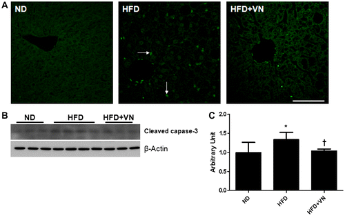 Fig. 6. Effect of the VN extract on hepatic apoptosis in HFD-fed mice.Notes: (A) Representative microphotographs showing the TUNEL analysis. Arrows indicate TUNEL-positive cells. The scale bar shows 50 μm. (B) Western blotting for hepatic cleaved caspase-3 expression in each group (n = 3–4 mice per group). (C) Quantification of cleaved caspase-3 expression from the Western blotting analysis. Data are presented as the mean ± SEM.*p < 0.05 vs. ND mice; †p < 0.05 vs. HFD mice.