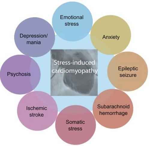 Figure 2 Connection between stress-induced cardiomyopathy (SIC) and neuropsychiatry.