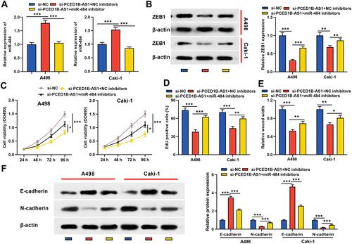 Figure 6 PCED1B-AS1 played a carcinogenic role in ccRCC cells through the miR-484/ZEB1 axis. miR-484 inhibitors or NC inhibitors were co-transfected into A498 and Caki-1 cells with PCED1B-AS1 silenced. (A) qRT-PCR was employed to detect miR-484 expression. (B) Western blotting was used to detect ZEB1 protein expression. (C, D) CCK-8 and EdU were used to detect the proliferation of A498 and Caki-1 cells. (E) Wound healing test was used to detect the migration of A498 and Caki-1 cells. (F) Western blotting was used to detect the expression level of EMT-related proteins. *P < 0.05, **P < 0.01, and ***P < 0.001.