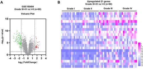 Figure 1 Gene expression levels between advanced and early renal cancer. (A) Volcano map of gene expression level in ccRCC based on GSE150404 dataset. (B) Heat map showing gene expression in ccRCC based on GSE150404 dataset. Black dots represent genes with no difference in expression level, blue dots represent downregulated DEGs, and purple dots represent upregulated DEGs.