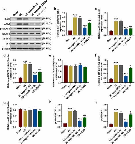 Figure 8. (a-i) Western blot was used to detect the expressions of IL-6 R, JAK1, p-STAT3, STAT3, p-p65 and p65 in colon tissues of mice in Sham, UC, UC + agomiR-NC, UC + agomiR-125-5 and UC + siIL6R groups. All the experiments have been performed in triplicate. *** P < 0.001 vs. Sham; # P < 0.05, ## P < 0.01, ### P < 0.001 vs. UC; ^^^P < 0.001 vs. UC + agomiR-NC