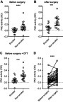 Figure 2 PAD activity in serum after CABG surgery. ELISA microtiter plates coated with human fibrinogen were incubated for 4 hrs with sera from 36 patients who had undergone CABG surgery, either with 1 mM DTT (+DTT) or without additives (no DTT). As negative control, each serum was tested in the presence of 25 mM EDTA. (A) PAD activity in serum among smokers and non-smokers before surgery. (B) PAD activity in serum of smokers and non-smokers after surgery. (C) PAD activity at baseline in serum containing 1 mM DTT. (D) PAD activity of all untreated serum samples before and after surgery. Citrullination was measured using anti-citrullinated fibrinogen mAb (20B2) recognizing a citrullinated epitope in fibrinogen. Data are expressed as average OD of duplicate measurements after subtraction of the negative controls, and median and interquartile ranges of the dataset are shown. ***p<0.001, ****p<0.0001.Abbreviations: PAD, peptidylarginine deiminase; CABG, coronary artery bypass grafting; DTT, dithiothreitol.