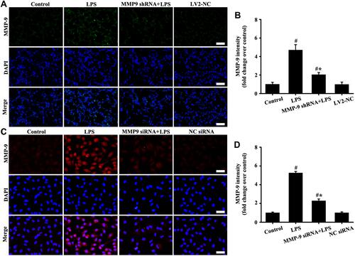 Figure 5 Downregulation MMP-9 expression in vivo and in vitro. The mice were injected by tail vein with a of total 2U MMP-9 shRNA, and then exposed to LPS for stimulation of six hours LPS. The A549 cells were transfected with 40 nM MMP-9 siRNA and Lipofectamine 2000 for 48 hours, and then added with LPS (100 ng/mL) for stimulation of six hours. MMP-9 in vivo (A, magnification, × 200; scale bar, 50 μm) and vitro (C, magnification, × 200; scale bar, 50 μm) was detected by immunofluorescence. (B and D) are fluorescence intensity analysis of (A and C) respectively. All data are presented as the mean ± SD of three independent experiments. #p < 0.05 vs the control group, #*p < 0.05 vs the LPS group.