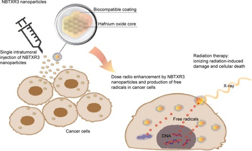 Figure 5 Schematic representation of the radio enhancement mechanism of NBTXR3 nanoparticles in cancer cells after an intratumoral injection.