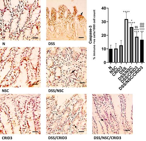 Figure 6 Immunostaining of caspase-3. Photomicrographs of specimens from: (N), (NSC), and (CRID3) show mild caspase-3 cytosolic expression in the epithelium of the crypts; (DSS), displays marked expression of caspase-3 mostly in the degenerated crypts (filled arrow); (DSS/NSC) and (DSS/CRID3), show a reduction in the caspase-3 expression (filled arrow); (DSS/NSC/CRID3), shows marked decrease in the caspase-3 expression (filled arrow). As shown in caspase-3 immunoreactivity evaluation figure, a significant reduction in the percentage of caspase-3 immunopositive cells/1000 counted cells was detected in rats treated with NSC, and more significantly with CRID3 and DSS/NSC/CRID3 compared with the untreated DSS rats. Caspase-3 IHC, bar = 50 µm. ++P < 0.01 vs N, +++P < 0.001 vs N, ++++P < 0.0001 vs N, * P < 0.05 vs DSS, ****P < 0.0001 vs DSS, @@@@P < 0.0001 vs DSS/NSC, $$P < 0.0001 DSS/CRID3 vs DSS/NSC.