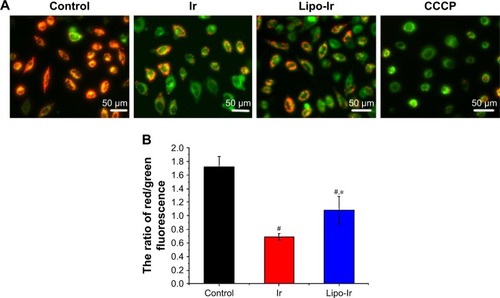 Figure 4 Assay of A549 cells mitochondrial membrane potential with JC-1 staining method.Notes: (A) The depolarization of mitochondrial membrane potential was observed (the magnification for the figure is 200×) after the cells were exposed to Ir (3 μM), equivalent Lipo-Ir for 24 h, or CCCP (as positive control). (B) Quantitative analysis of ratio of red/green fluorescent intensity. Results of the red and green fluorescence are overlapped and expressed as mean ± SD of triplicates. The Lipo-Ir-treated group exhibits significant difference compared with the Ir (*P<0.05). The significant difference is observed among the treatment group and the blank control group (#P<0.05).Abbreviations: Ir, iridium; Lipo-Ir, Ir-loaded PEGylated liposomes; JC-1, 5,5′,6,6′-tetrachloro-1,1′,3,3′-tetraethylbenzimidazolcarbocyanine iodide; PEG, polyethylene glycol.