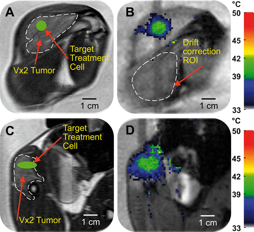 Figure 2. Planning and temperature mapping for mild hyperthermia: (A) VX2 tumour (hyper-intense) was clearly identified (white dashed line) on the proton density-weighted planning images and a target region within the tumour was chosen (green circle). (B) Temperature maps (colour scale) overlaid on planning images (greyscale) during a mild hyperthermia treatment with an 8 mm treatment cell, showing typical temperature distribution after 5 min of heating. Temperature monitoring and control was achieved in the selected target region with an FFE-EPI imaging sequence, utilising the PRFS method for temperature mapping, and by using the mild hyperthermia feedback control algorithm. The ROI used for magnetic drift correction is outlined with a white dashed line. C and D are the sagittal image planes corresponding to A and B, respectively.
