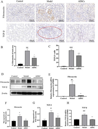 Figure 5. ADSC treatment alleviated glomerular and tubulointerstitial fibrosis in an model rats. a) Immunohistochemistry staining of Fibronectin and TGF-β1 in kidney tissues (N = 7). b) the Fibronectin positive area was quantitatively analyzed (N = 7). c) the TGF-β positive cells were quantitatively analyzed (N = 7). d) Western blot bands of Fibronectin and TGF-β1 in kidney tissues. e) Western blot analysis of fibronectin in kidney tissues. f) Western blot analysis of TGF-β1 in kidney tissues. g) the mRNA expression of fibronectin in kidney tissues (N = 7). h) the mRNA expression of TGF-β1 in kidney tissues (N = 7). Data are presented as mean ± SEM. ****p < 0.05, *p < 0.01, **p < 0.01 vs model. ***p < 0.05, #P < 0.001, *p < 0.001 vs control group.