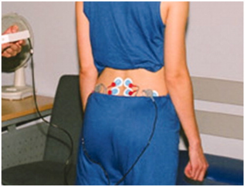 Figure 3. The placement of EMG electrodes.