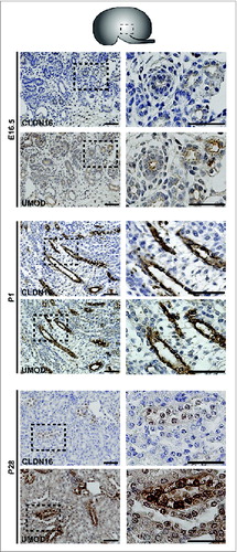 Figure 4. Protein Expression of Claudin-16 during Mouse Kidney Development. Immunohistochemistry was performed on paraffin-embedded sections taken from mouse kidneys at E16.5, P1 and P28 as shown. Claudin-16 is expressed in primitive and mature Loop of Henle tubules as indicated by its overlapping expression with Uromodulin at all stages. A higher magnification of the boxed regions are shown to the right of each image. Scale bar = 50 μm.