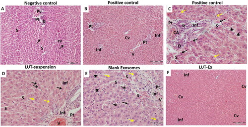Figure 5. Hematoxylin and eosin (H&E) staining of liver tissue of the different studied groups. (A) Negative control group showed classical hepatic architecture with branching anastomosing cords of hepatocytes one or two cell thickness radiating from central veins (Cv) and separated from each other by narrow sinusoids (S). The hepatocytes showed eosinophilic granular cytoplasm with vesicular nuclei and prominent nucleoli (arrow). The Portal tracts (Pt) with branches of portal veins (Pv) and bile ducts (b) were also seen. (B,C) Positive control group revealed extensive liver damage. (B) A low-power image showing several areas of mononuclear cellular infiltration, either in-between the hepatocytes (Inf), surrounding the central vein (Cv), or within the portal tracts (Pt), leading to disruption of the hepatic architecture. Congested portal vein is also noticed (V). (C) A high-power image demonstrating a marked hepatocellular degeneration. Many hepatocytes are seen with hyper-eosinophilic cytoplasm, loss of cytoplasmic granularity and dark nuclei (black arrows). Others are seen with rarified cytoplasm and dense irregular nuclei (yellow arrows). The portal tracts (Pt) are expanded by mononuclear cellular infiltration (Inf), with proliferation and dilatation of the bile ducts (b) and congested hepatic arterioles (CA). The hepatic sinusoids (S) are dilated and lined by many Kupffer cells (arrow heads). (D) LUT-suspension group illustrated showed restoration of the normal appearance of the hepatocytes with their pale large nuclei (black arrows). Moreover, many of them are binucleated (yellow arrows). Areas of mononuclear cellular infiltration (Inf) are still apparent in-between the cells or within the portal tract (Pt). The portal vein (V) and the hepatic sinusoids (S) are dilated and congested. (E) Plain exosomes group presented mild hepatic improvement. Hepatocytes appear more or less normal with slightly eosinophilic granular cytoplasm and large central vesicular nuclei with prominent nucleoli (black arrows). Additionally, numerous binucleated hepatocytes can be detected (yellow arrows). Areas of mononuclear cellular infiltration (Inf) are still seen within the portal tract (Pt) around the congested branch of the portal vein (V). The hepatic sinusoids (S) are dilated and congested. Many Kupffer cells are also noticed (arrow heads). (F) LUT-Ex group exhibited a prominent restoration of the liver architecture. The hepatocytes are apparently normal and arranged in cords 1–2 cell thickness. Limited sporadic regions of mononuclear cellular infiltration (Inf) are seen in-between the hepatocytes. Some central veins (Cv) are congested (H&E stain, Mic. Mag. A: ×200, B, F: ×100, C, D, E: ×400).