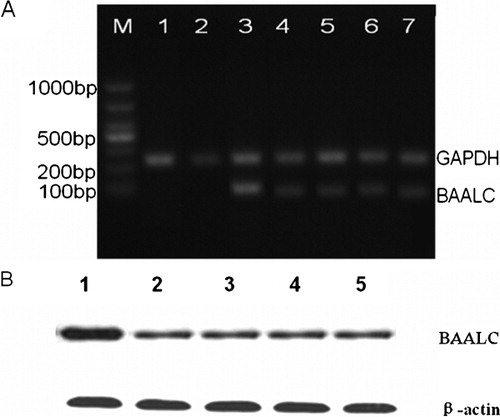 Figure 2. Effects of BAALC shRNA on mRNA and protein expression. (A) Results of 1% agarose gel electrophoresis showed that BAALC mRNA expression was decreased in cells transfected with pGPU6-BAALC-shRNA1-4. However, no change was observed in cells transfected with pGPU6-shRNA-NC. Lane 1: control; Lane 2: GAPDH-shRNA; Lane 3: GAPHD-shRNA-NC; BAALC: Lane 3: BAALC-shRNA-NC; Lanes 4–7: BAALC-shRNA-1-4. (B) Results of western blot showed that BAALC protein levels were markedly inhibited in pGPU6-BAALC-shRNA1-4 transfected leukaemia cells, in contrast to the negative control plasmid-transfected cells. Lane 1: BAALC-shRNA-NC, Lanes 2–5: BAALC-shRNA-1-4.