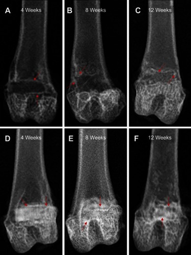 Figure 8 X-ray images revealing the repair of bone defects in blank group and 1% Cu-doped n-CDHA/MAC group at postoperative 4, 8, and 12 weeks: (A, B and C) blank group; (D, E and F) 1% Cu-doped n-CDHA/MAC group. (A and D), 4 weeks; (B and E), 8 weeks; (C and F), 12 weeks. The red arrow represents new bone formation in bone defect.Abbreviations: n-CDHA/MAC, nano calcium-defcient hydroxyapatite/multi(amino acid) copolymer.