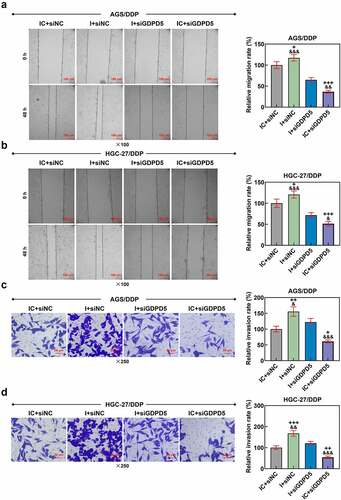 Figure 9. GDPD5 silencing diminished the effects of downregulated miR-874-3p on the migration and invasion of DDP-resistant GC cells. (a-b) The effects of GDPD5 silencing and miR-874-3p downregulation on the migration of DDP-resistant GC cells AGS/DDP (a) and HGC-27/DDP (b) were confirmed with Scratch assay at 0 and 48 hours, under × 100 magnification (Scale bar = 100 μm). (c-d) The effects of GDPD5 silencing and miR-874-3p downregulation on the invasion of DDP-resistant GC cells AGS (c) and HGC-27 (d) at 48 hours were detected with Transwell assay (× 250 magnification; Scale bar = 50 μm). All data were expressed as mean ± standard deviation (SD), which was indicative of three independent tests. +p < 0.05, ++p < 0.01, +++p < 0.001, vs. IC+siNC; &p < 0.05, &&p < 0.01, &&&p < 0.001, vs. I+ siGDPD5.