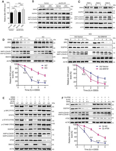 Figure 4. Impaired autophagic degradation of SRC is responsible for the accumulation and overactivation of SRC caused by SNX10 deficiency. (A and B) Src mRNA and the indicated proteins levels in normal colorectal epithelium and CRC tissues from control and snx10-cKO mice were measured by RT-qPCR and immunoblot. (C) Representative immunoblots of indicated proteins in tumor tissues (T) and paired adjacent normal tissues (N) from CRC patients. (D) WT and SNX10 knockout Caco-2 cells and SNX10 knockout Caco-2 cells infected with Ad-Vector or Ad-SNX10 were subjected to EBSS for the indicated duration and then harvested for immunoblotting analysis. SRC levels were quantified by densitometry (Lower panel). (E) WT and SNX10 knockout Caco-2 cells transfected with non-targeting siRNA (Si-NC) or ATG5-siRNA (Si-ATG5) were treated with EBSS for 6 h, followed by immunoblotting experiment. (F) Caco-2 cells transfected with non-targeting siRNA (Si-NC) or ATG5-siRNA (Si-ATG5) were subjected to starvation for the indicated duration and harvested for immunoblotting analysis. SRC levels were quantified (Lower panel). Data are represented as mean ± SEM. NS, not significant; *, p < 0.05; **, p < 0.01; ***, p < 0.001; by 2-tailed, unpaired t-test.