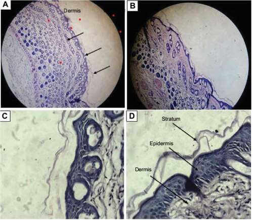 Figure 14. Vertical section histological microphotograph of mouse skin after staining with hematoxylin and eosin A) Placebo treated skin sample at view of lower power (×100); (B) miconazole loaded nanoemulsion (1%w/w) skin sample at view of lower power (×100); (C) saline treated skin sample at view of higher power (×400); (D) miconazole loaded nanoemulsion treated skin at view of higher-power (×400)