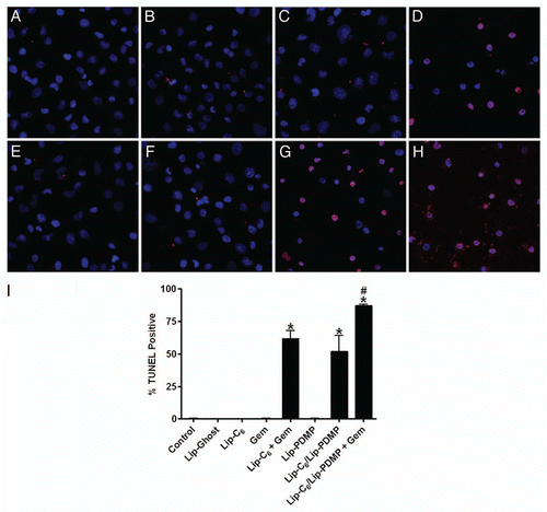 Figure 2 Lip-C6, Lip-PDMP and gemcitabine cooperatively induce apoptosis of PANC-1 cells. Apoptosis of PANC-1 cells was detected by TUNEL assay following 24 h treatments with: (A) saline control, (B) Lip-C6 (5 µM C6-ceramide), (C) 20 µM gemcitabine (Gem), (D) Lip-C6 (5 µM C6-ceramide) + 20 µM Gem, (E) Lip-Ghost (empty nanoliposome), (F) Lip-PDMP (5 µM PDMP), (G) Lip-C6/PDMP (5 µM C6-ceramide and 5 µM PDMP), and (H) Lip-C6/PDMP (5 µM C6-ceramide and 5 µM PDMP) + 20 µM Gem. (I) Apoptotic cells were quantified as a percent of the total cell number. One-way ANOVA: *p < 0.001 compared with control, Lip-Ghost, Lip-C6, Gem and Lip-PDMP, #p < 0.05 compared with Lip-C6 + Gem and Lip-C6/Lip-PDMP, n = 5.