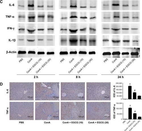 Figure 4 Effects of EGCG on the production of TNF-α, IL-6, IL-1β, and IFN-γ in mice with ConA-induced acute hepatitis.