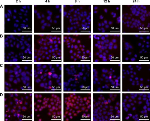 Figure 5 Cellular uptake of siRNAcy5-loaded PEAL NPs.Notes: Fluorescence inverted microscope images of MCF-7/ADR cells treated with (A) free siRNAcy5, (B) siRNAcy5-loaded PEAL NPs, (C) free siRNAcy5 + UTMD, and (D) siRNAcy5-loaded PEAL NPs + UTMD, respectively.Abbreviations: siRNA, small interfering RNA; PEAL NPs, mPEG-PLGA-PLL nanoparticles; mPEG-PLGA-PLL, monomethoxy polyethylene glycol–polylactic acid/glycolic acid–poly(L-lysine) triblock copolymer; UTMD, ultrasound targeted microbubble destruction; h, hours.