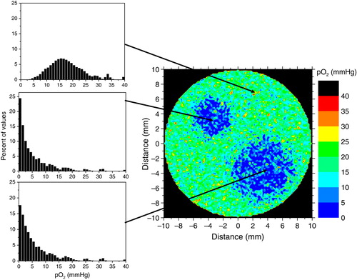 Figure 1.  Simulated oxygen distribution in a theoretical tumour used in this study. It was assumed that the simulated tumour has two hypoxic islands surrounded by cells that are better oxygenated. The local oxygen distributions for each region are indicated in the insets.
