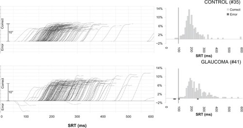 Figure 1 Traces of individual saccades for two subjects (left) and histograms of corresponding reaction times (right).a
