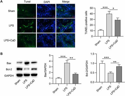 Figure 5. The apoptosis in mouse model of AKI was reduced after CaD treatment. (a) TUNEL staining of kidney sections in various groups and quantitation of TUNEL-positive cells. (b) Western blot analysis of kidney sections in various groups and quantitation of Bax and Bcl-2 protein levels. N = 10 in each group. *p  <  0.05; **p  <  0.01; ***p  <  0.001.