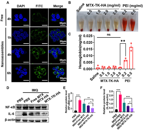 Figure 3 (A) CLSM images of HaCaT cells incubated with FITC-nanoassemblies for 1h, 4 h and 6h, respectively. Nucleus was stained with DAPI (blue). Scale bars are 30μm. (B and C) Hemolysis assay of MTX-TK-HA/PLA-mPEG nanoassemblies. PEI was used as the positive control. (D-F) Western blot analysis of NF-κB and IL-6 expression in IMQ induced HaCaT cells. Results are presented as the mean ± SD (n=3). *P<0.05, **P<0.01 and ***P<0.001, One-Way ANOVA test.