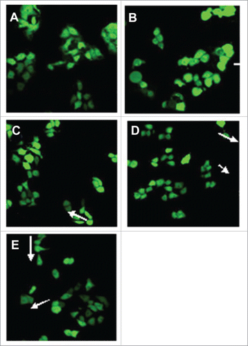 Figure 2. Morphological appearance of HaCaT cells treated with different doses of Schizandrin B by Confocal microscopy detection (×400): A HaCaT cells treated with 0.1% DMSO; B HaCaT cells treated with 0.1%DMSO + UVB; C HaCaT cells treated with 0.1 mol/L SchB + UVB; D HaCaT cells treated with 1 μmol/L SchB + UVB; E HaCaT cells treated with 10 μmol/L SchB + UVB.