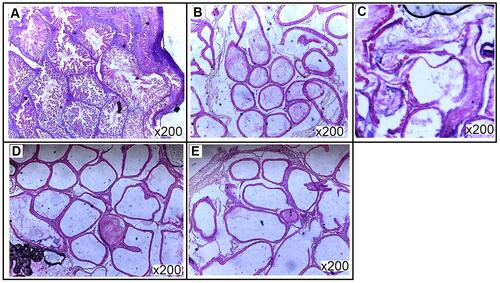 Figure 8 Representative photomicrographs of histological assessment of the epididymides of Sprague-Dawley rats after 60 days of treatment. (A) Normal saline–treated rats showing well-layered seminiferous tubules with different stages of spermatogenic cells; (B) MSG-treated rats showing necrosis in connective tissue; (C) 1,000 mg/kg SJRE–treated rats showing disorganization of cells and epididymitis; (D) 1,000 mg/kg CBRE–treated rats showing greatly convoluted tubules, but with very scanty spermatozoa; (E) 1,000 mg/kg PPRE–treated rats showing greatly convoluted tubules, but with scanty spermatozoa (transverse section, 200×, H&E stain).