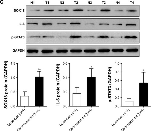 Figure 1 SOX18 mRNA expression was correlated with IL-6 mRNA expression in osteosarcoma tissues.