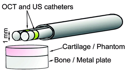 Figure 2. The measurement setup. Adjacent optical coherence tomography (OCT) and ultrasound (US) catheters were inserted through an instrument channel. The phantom measurements were performed in distilled water and the cartilage measurements in a bath of phosphate-buffered saline.