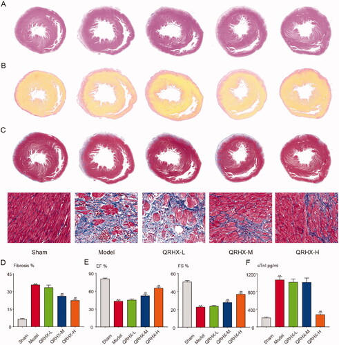 Figure 6. QRHX improves cardiac function and reduces the fibrosis area in MI rats. (A) H&E staining, (B) Sirius red staining, (C) Masson staining of heart tissue. (D) Area of fibrosis in each group. (E) LVEF and LVFS levels of rats in each group. (F) Myocardial infarction marker level of cTnl. Data were expressed as mean ± SEM. **p < 0.01 vs. Normal group, #p < 0.05 and ##p < 0.01 vs. Model group.