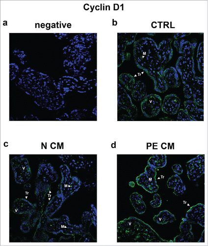 Figure 7. Cyclin D1 spatial localization in physiological placental villous explants treated with culture media conditioned by normal or PE-PDMSC. (A) Absence of positive immunoreactivity for Cyclin D1 in section stained with control IgG. B) Cyclin D1 spatial localization in physiological villous explants treated with unconditioned media (CTRL, n = 4 explants) assessed by immunofluorescent staining. C) Cyclin D1 spatial localization in physiological villous explants treated with media conditioned by normal (N CM, n = 4 explants) assessed by immunofluorescent staining. C) Cyclin D1 spatial localization in physiological villous explants treated media conditioned by with preeclamptic (PE CM, n = 4 explants) assessed by immunofluorescent staining. Cell nuclei are showed in blue by DAPI signal. TR, trophoblast cells; M, mesenchyme; V, vessel. Original magnifications, x40.